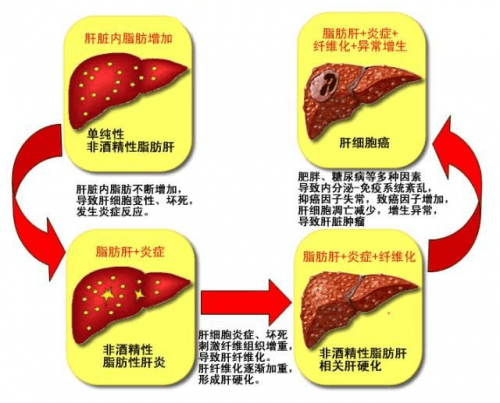 肝脏位置图，有什么功能？一次性告诉你